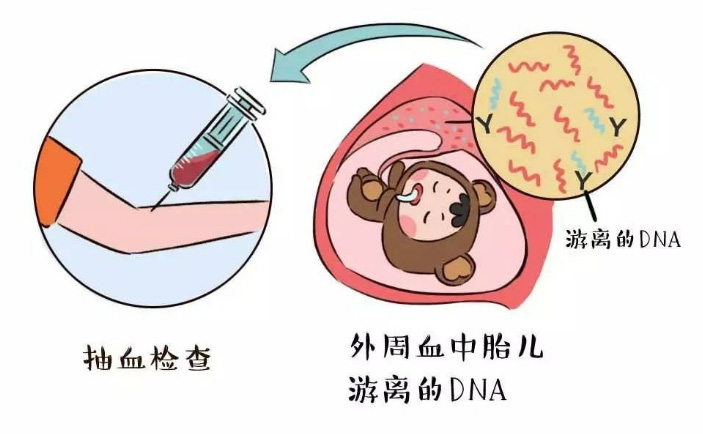 无创DNA检测显示胎儿DNA浓度不
